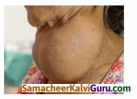 Samacheer Kalvi 10th Science Guide Chapter 16 தாவர மற்றும் விலங்கு ஹார்மோன்கள் 90